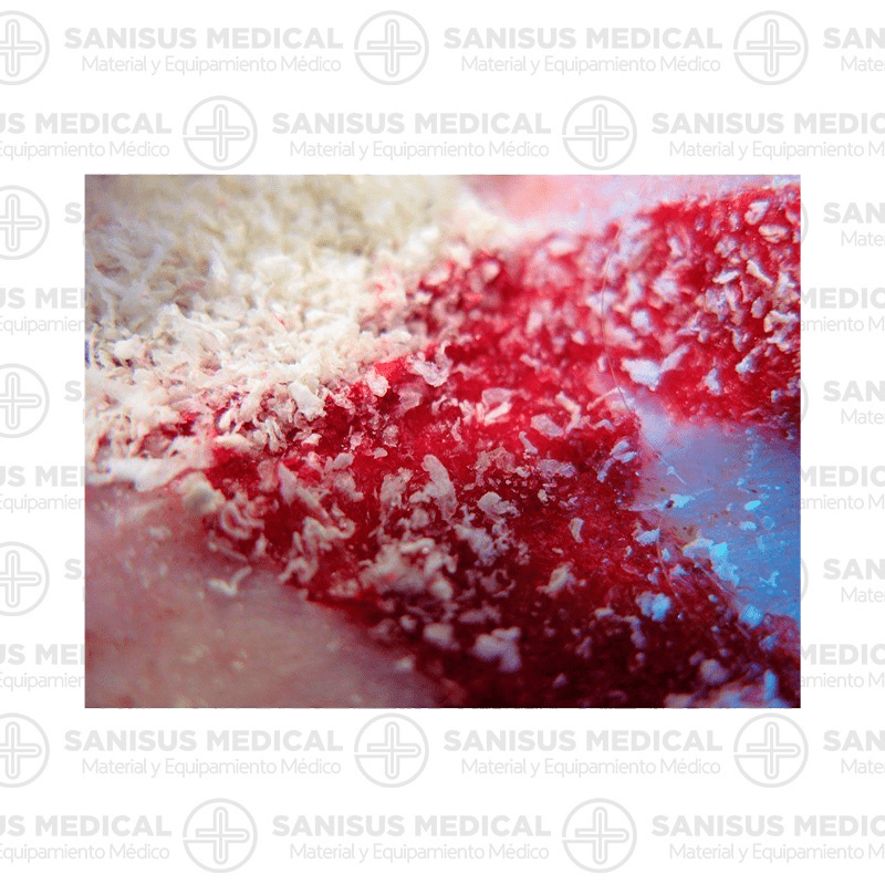 CELOX Aplicador de gránulos Hemostáticos