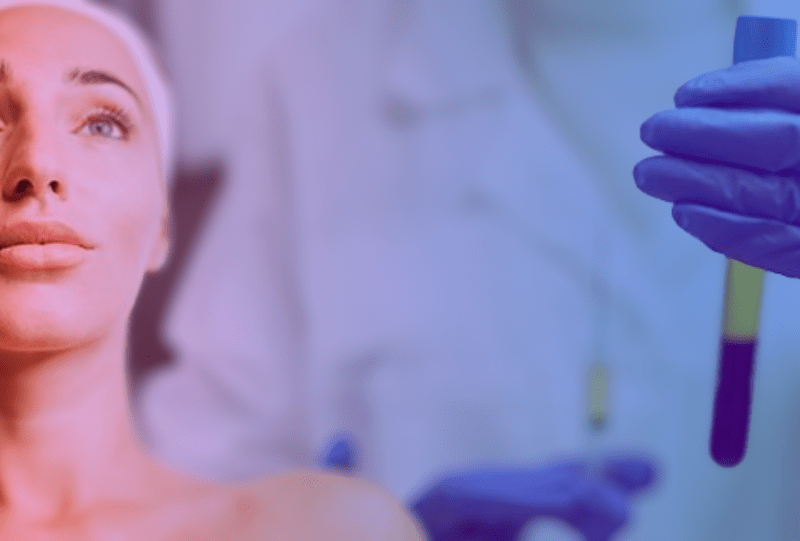 Material para tratamientos con PRP plasma rico en plaquetas